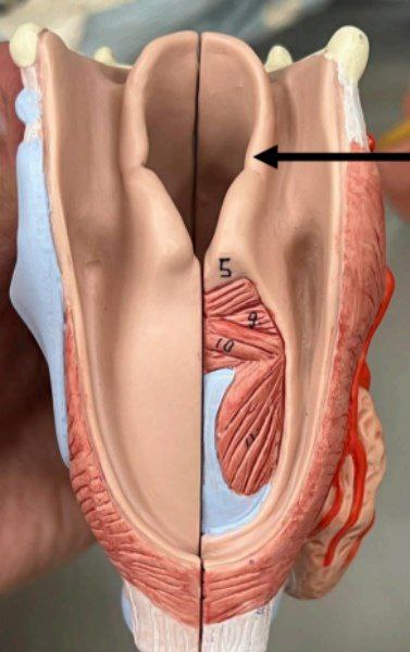 <p>Identify the following</p>