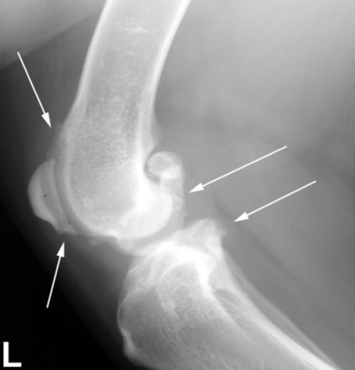 <p>Identify the pathology?</p>