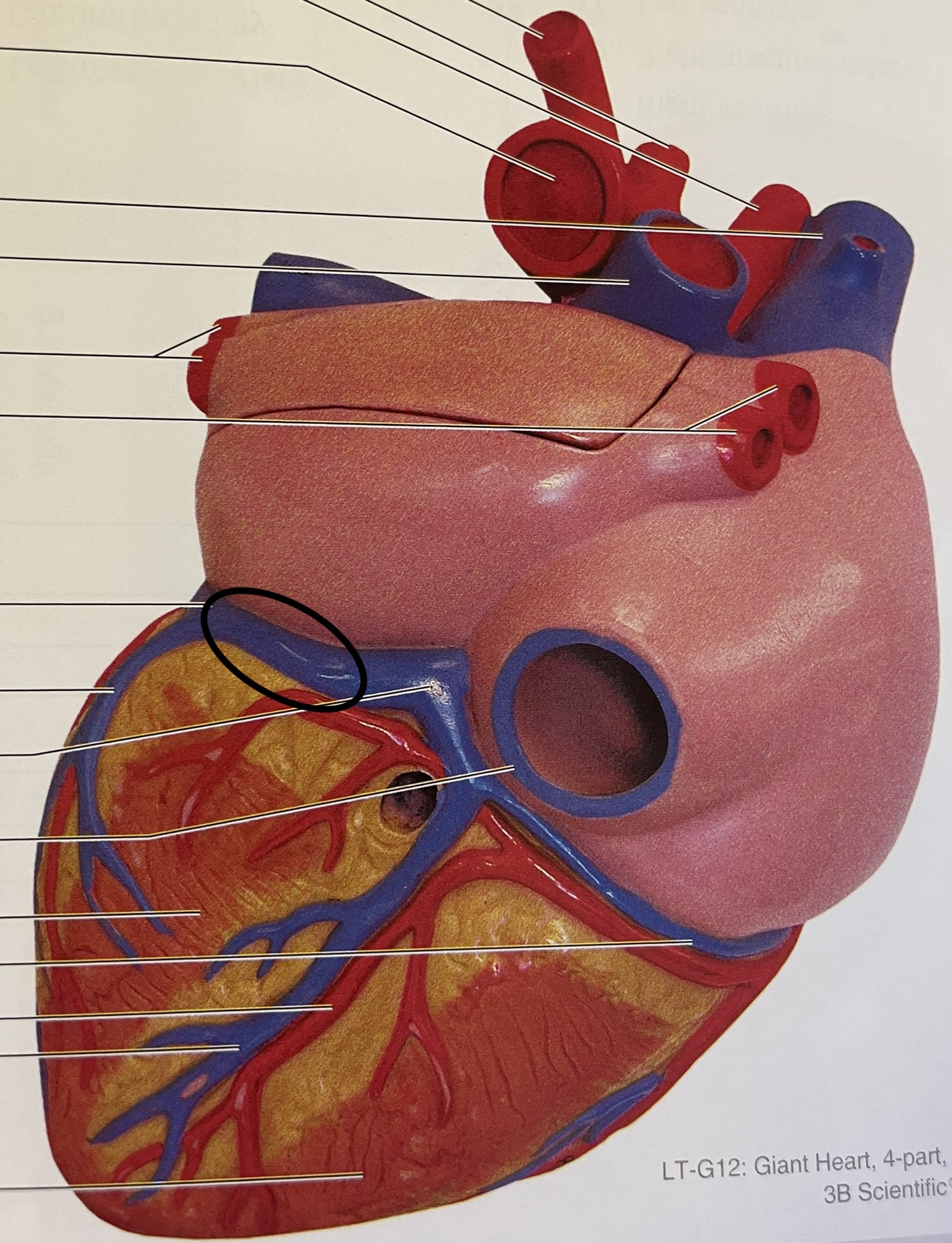 dump into coronary sinus on posterior