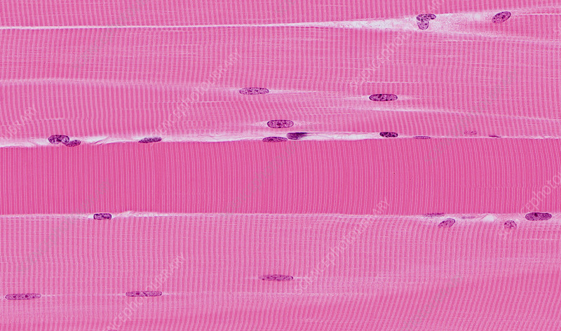 <p>Voluntary and found in all muscles that help move the skeleton </p>
