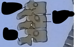 <p>Thoracic vertebrae parts</p>
