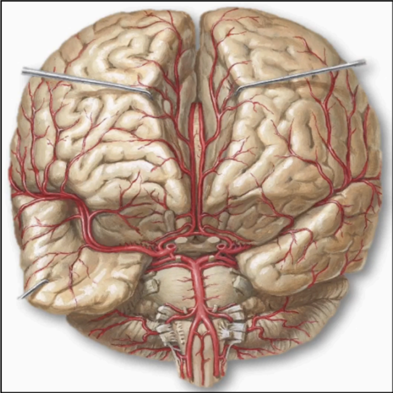 <p>Anterior Cerebral Artery (ACA)</p>