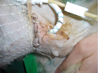 <p>Complications </p>