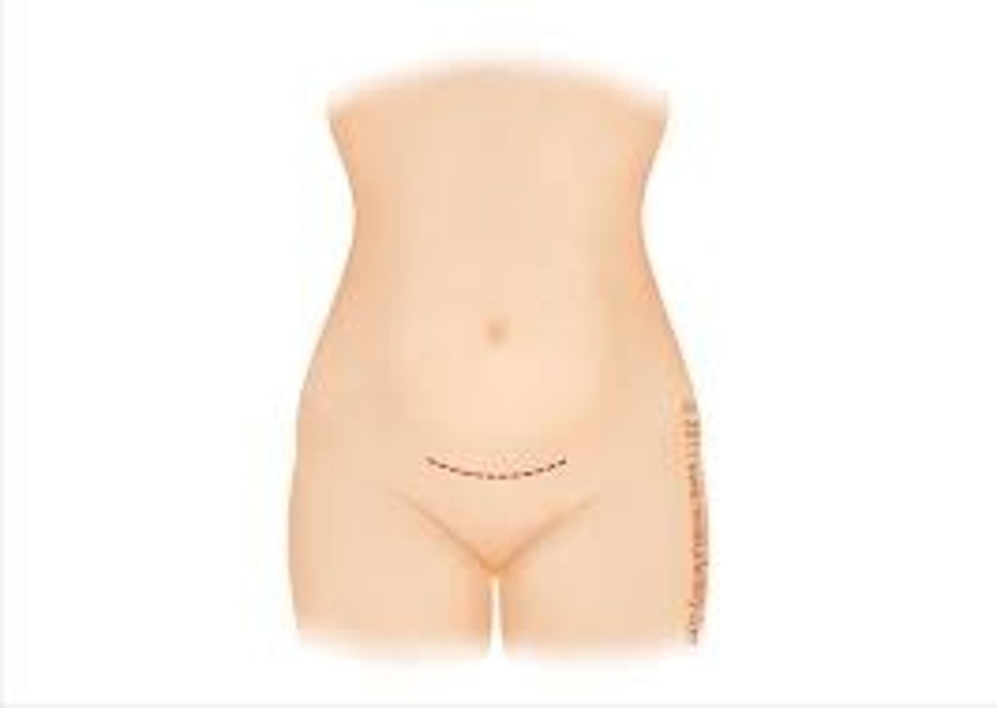 <p>low transverse abdominal incision <strong>w/ retraction of the rectus muscle laterally</strong></p><p><strong>Most often used in gyno surgeries</strong></p>