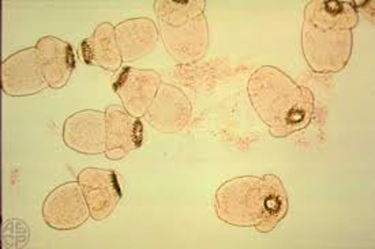 <p>Diagnostic stage</p><p>Protoscolices in hydatid</p>