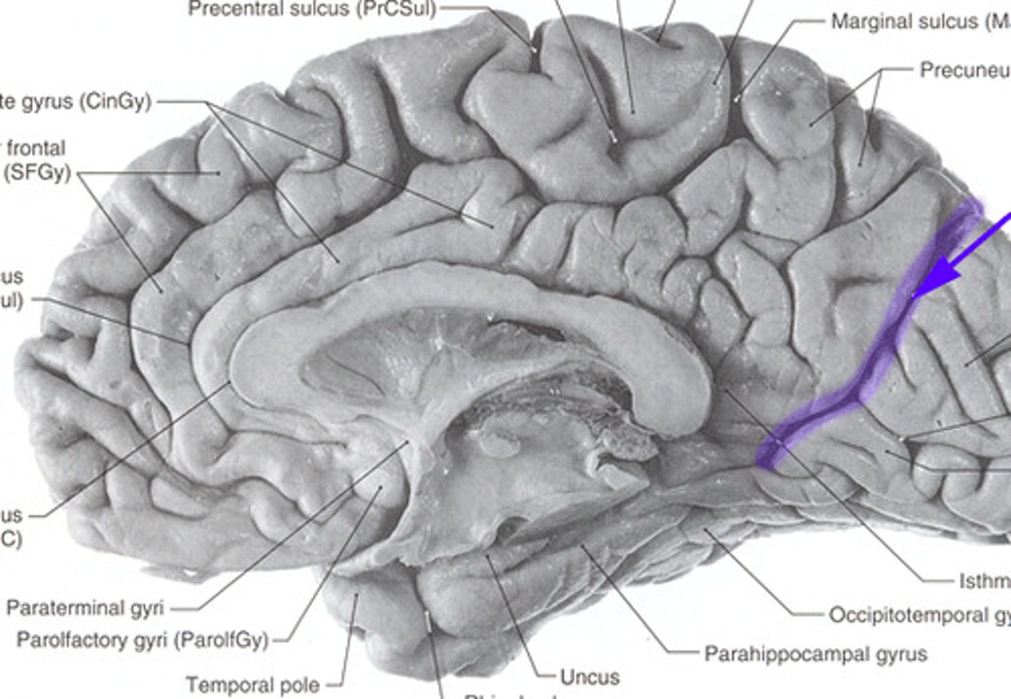<p>divides parietal and occipital lobes</p><p>- you can see It more from the medial view (inner view)</p>