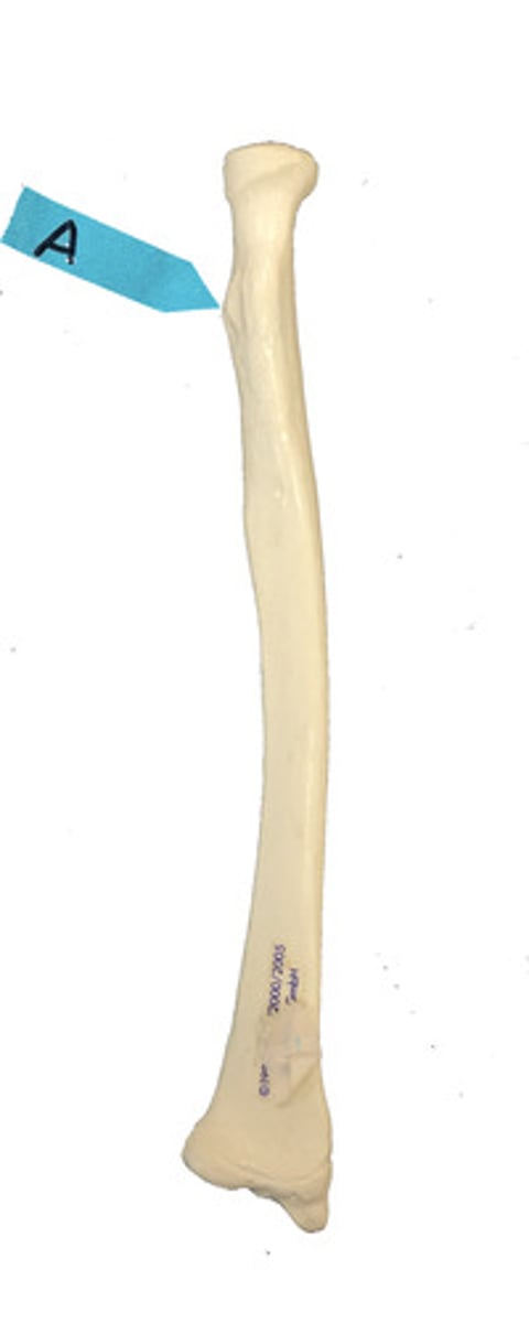 <p>Identify this bone marking.</p>