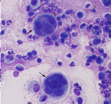 <p>What cell is the black arrow pointing to?</p>