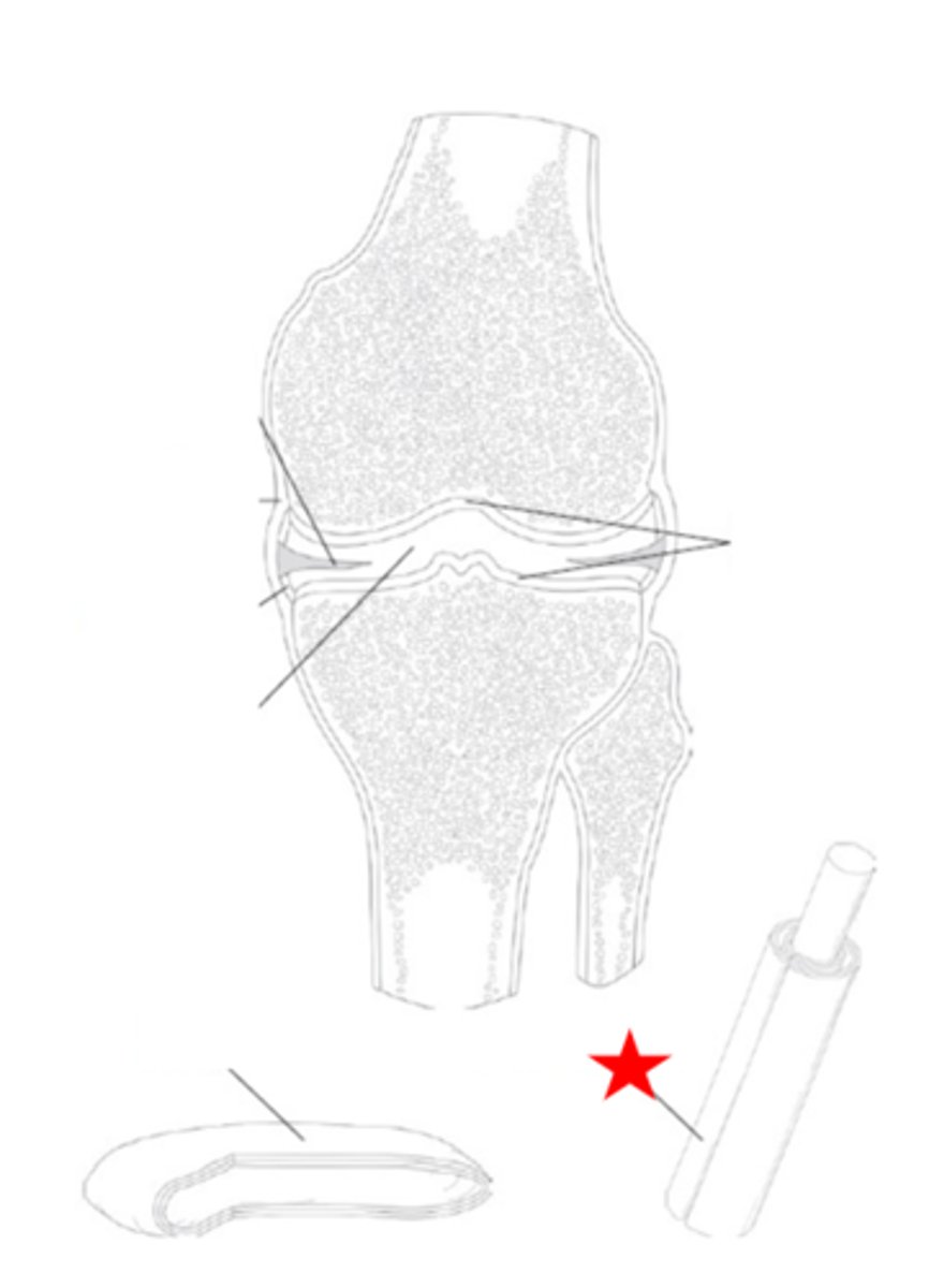 <p>Identify the synovial joint structure that star is pointing to.</p>