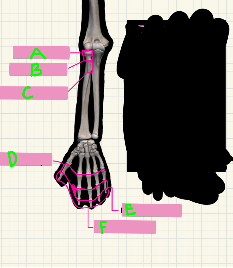 <p>What’s A-C?</p>