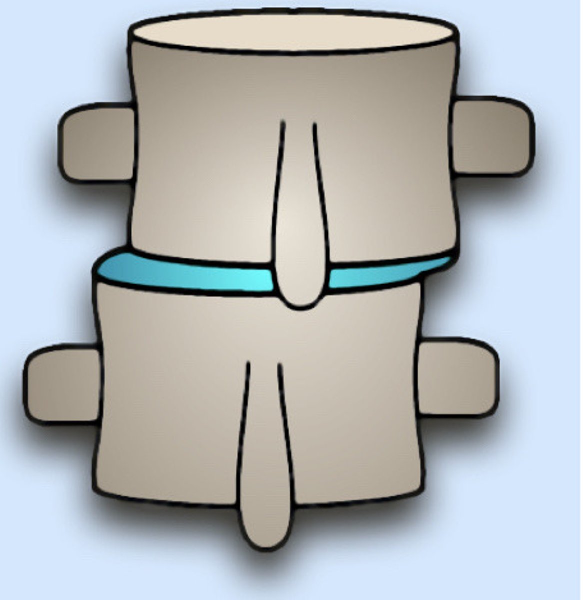 <p>+X translation restriction (motion listing)</p>