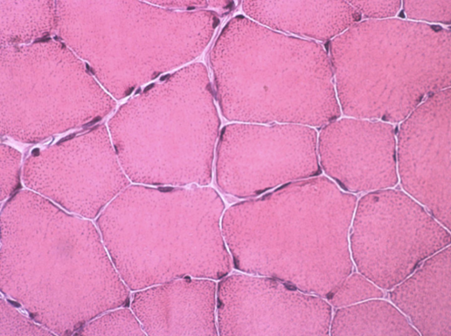 <p>Which type of striated muscle tissue is presented in the following image:</p>