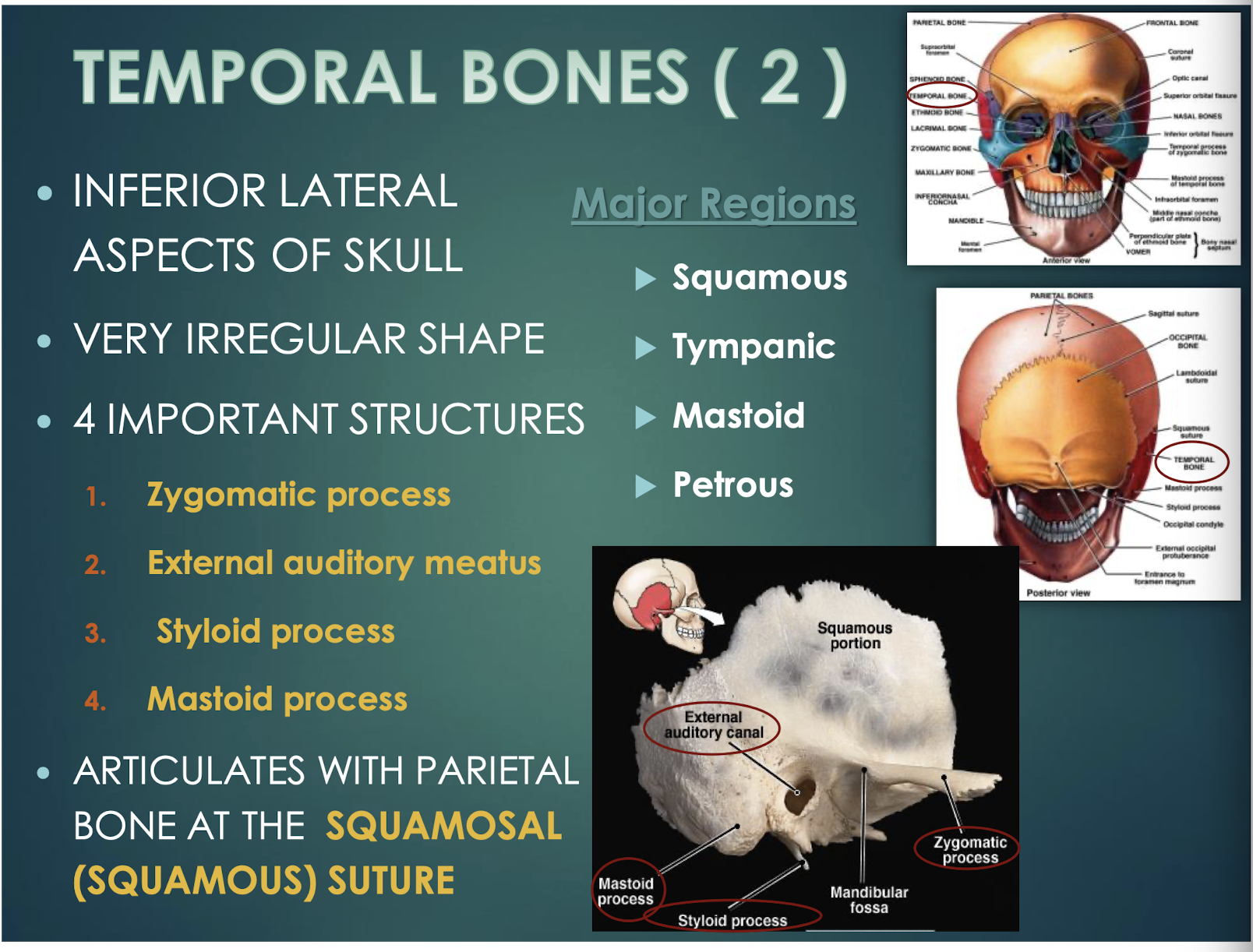<p>Temporal Bones</p>