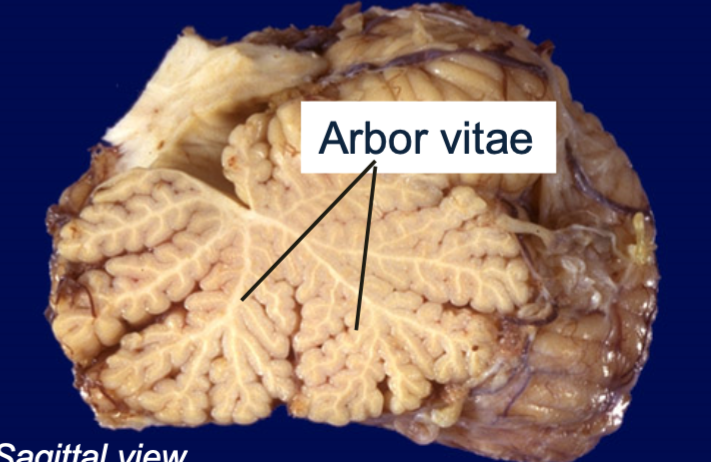 1. AKA tree of life
2. White matter in cerebellum 