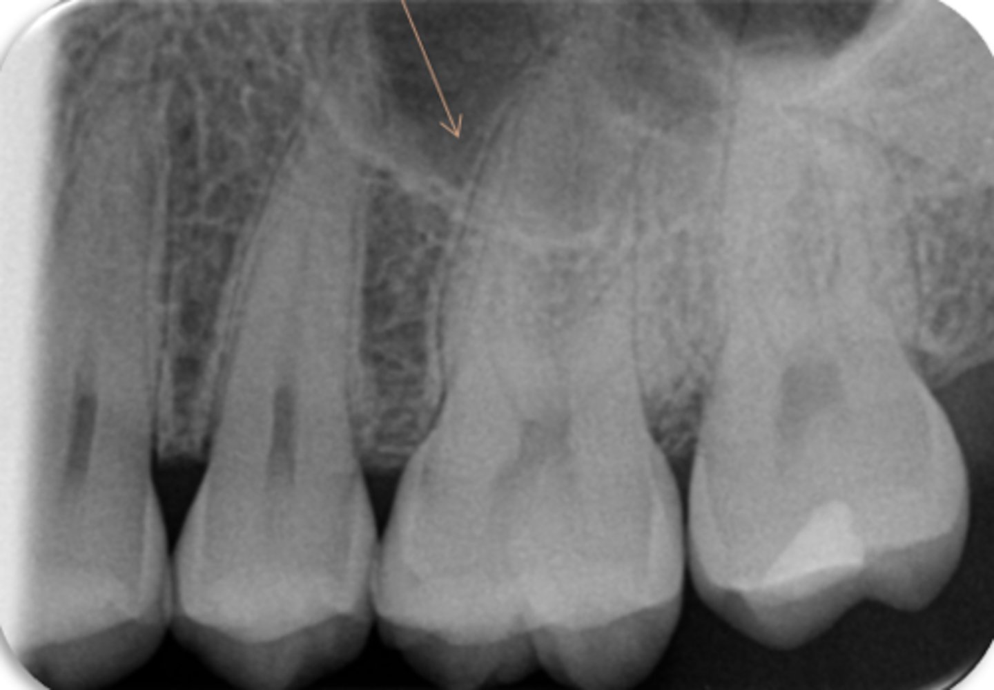 <p>ID the structure:</p>