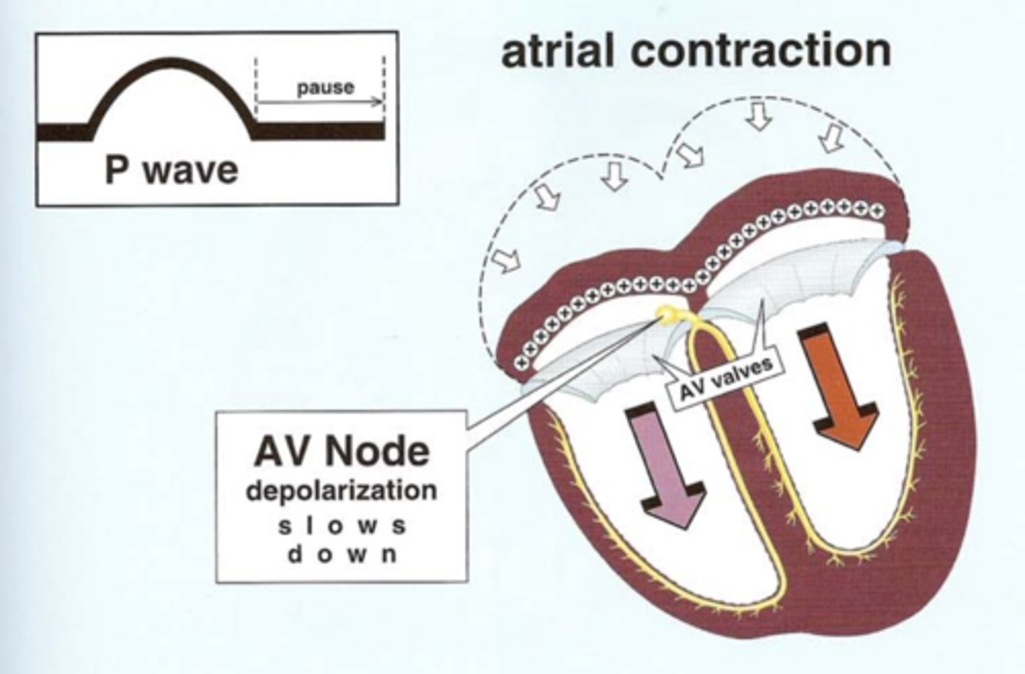 <p>Depolarization conducts slowly through the AV Node, since it is carried by slow moving calcium ions.</p>