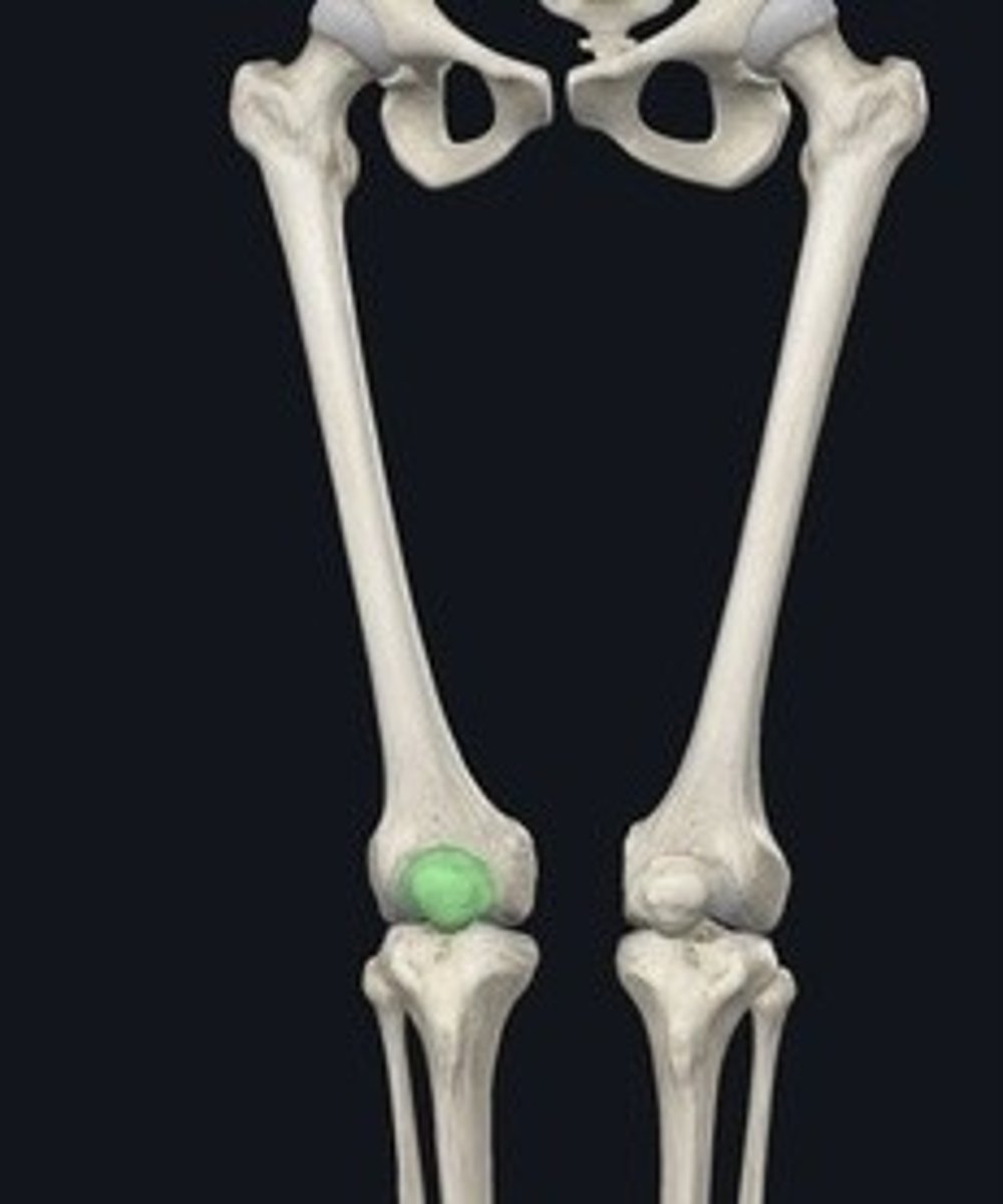 <p>Kneecap; protects knee joint.</p>