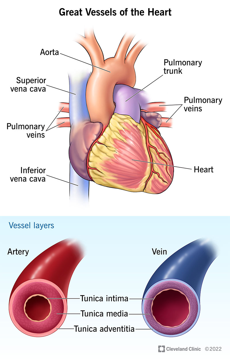<p>Aorta - leaves the LV (largest)</p><p>Pulmonary arteries - leave the RV (carry deoxygentated blood to the lungs)</p><p>Pulmonary veins (4) - oxygenated from lungs</p><p>Vena Cava - Superior and Inferior -&nbsp;</p><ul><li><p>SVC syndrome (tumor compression) - impedes lymphatic drainage (edema superior) - veins better at handling edema then arteries&nbsp;</p></li><li><p>IVC syndrome lower extremity edema</p></li></ul><p></p>