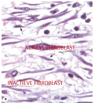 <ul><li><p>meest algemeen voorkomende bindweefselcel</p></li><li><p>produceren collagene &amp; elastische vezels en glycosaminoglycanen &amp; glycoproteïnen van de grondsubstantie</p></li><li><p>2 soorten:</p><ul><li><p>actieve fibroblasten → grotere cellen met grotere actieve ‘euchromatische’ kern &amp; meer uitgesproken cytoplasma</p></li><li><p>inactieve fibroblasten (= fibrocyten) → kleinere cellen met kleinere &amp; meer ‘heterochromatische’ kern &amp; minder cytoplasma</p></li></ul></li></ul><p></p>