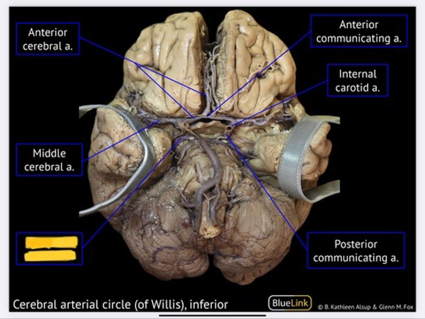 knowt flashcard image
