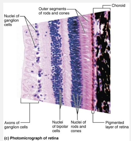 <p><strong>Outer pigmented layer </strong></p><ul><li><p><strong>STRUCTURE </strong></p><ul><li><p>Single-cell-thick lining next to choroid </p></li><li><p>Extends anteriorly, covering ciliary body and iris </p></li></ul></li><li><p><strong>FUNCTION </strong></p><ul><li><p>Absorbs light and prevents its scattering </p></li><li><p>Phagocytizes photoreceptor cell fragments </p></li><li><p>Stores vitamin A </p></li></ul></li></ul><p><strong>Inner neural layer</strong></p><ul><li><p><strong>STRUCTURE </strong></p><ul><li><p>Transparent layer </p></li><li><p>Composed of three main types of neurons </p><ol><li><p>Photoreceptors</p></li><li><p>Bipolar neurons </p></li><li><p>Ganglion cells  </p></li></ol></li></ul></li><li><p><strong>FUNCTION </strong></p><ul><li><p>Signals spread from photoreceptors to bipolar cells to ganglion cells </p></li><li><p>Ganglion cell axons exit eye as optic nerve</p></li></ul></li></ul><p></p>