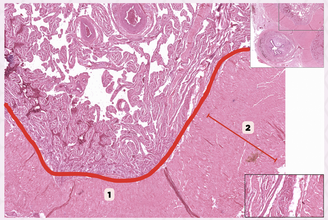 <p>Identify the structure labeled as 2.</p>