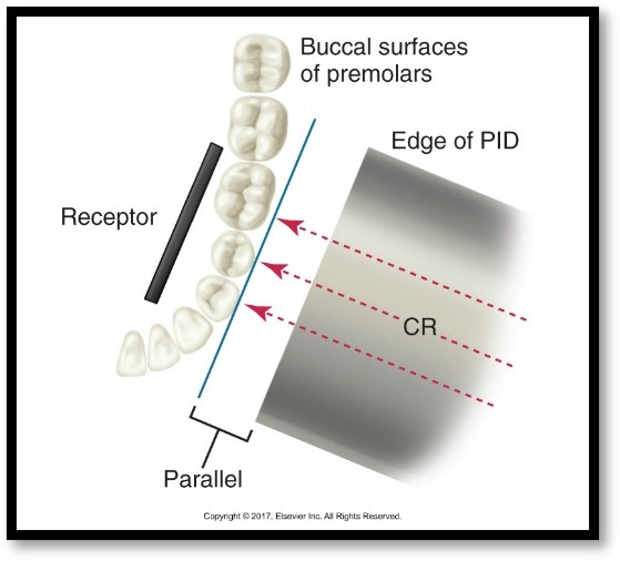 <p>Open contacts are important for revealing interproximal caries.&nbsp;</p><ul><li><p>Image 1 overlap hiding the caries&nbsp;</p></li><li><p>Image 2 has better horizontal angulation but still some overlap</p></li><li><p>Image 3 open contacts shows full extent of interproximal caries.&nbsp;</p></li></ul><p></p>