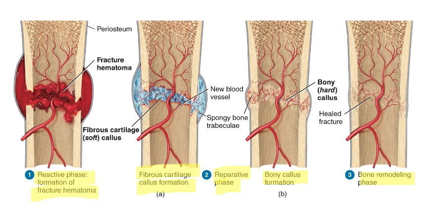 <ol><li><p>reactive phase (early inflammatory phase)</p></li><li><p>reparative phase (formation of fibrocartilaginous callus, then bony callus)</p></li><li><p>bony remodeling phase (bony callus is remodeled)</p></li></ol>
