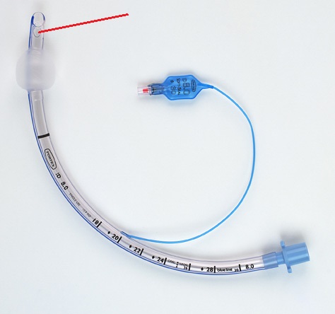 <p>The little hole in some ET tubes, allowing for breathing if the main tube gets blocked. Like the little hole in lollypop sticks!</p>