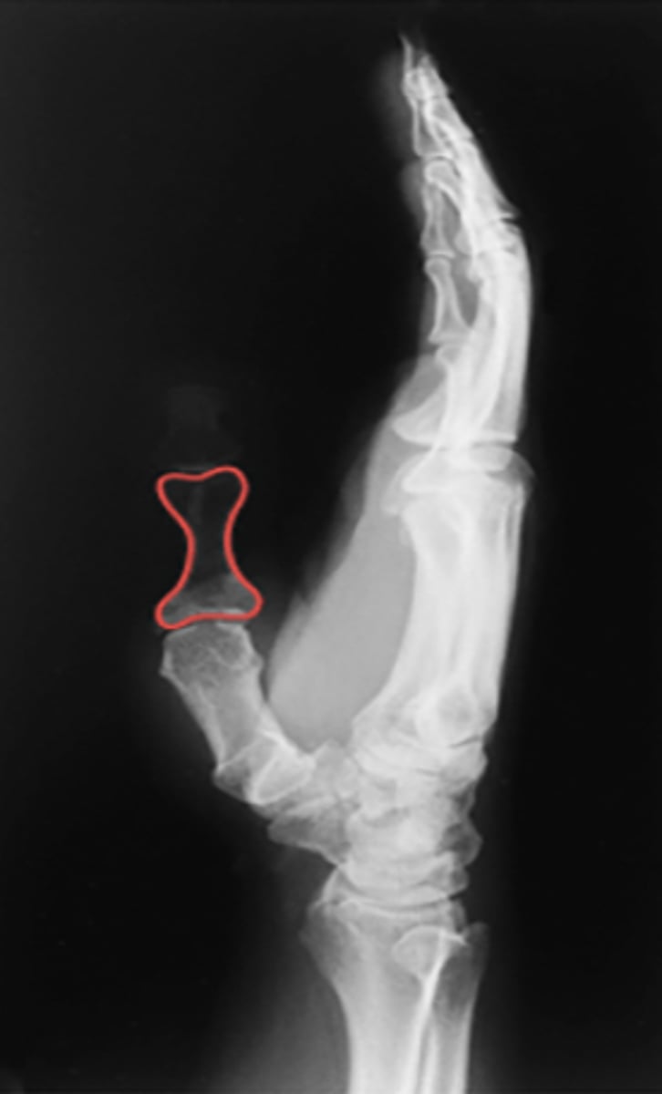 <p>What structure is highlighted?</p>