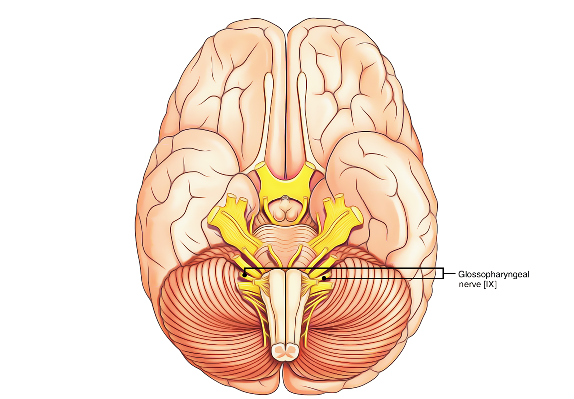 <p>glossopharyngeal (IX)</p>