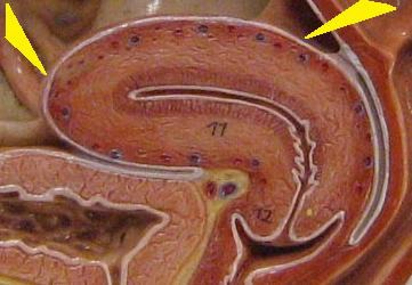 <p>outer layer of uterus</p>
