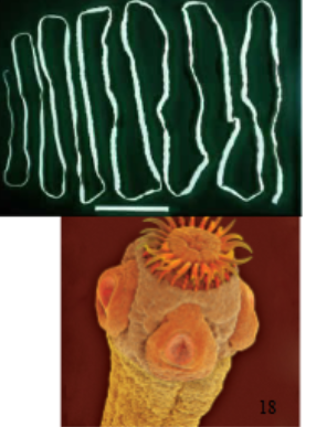 <p>Platyhelminthes</p>