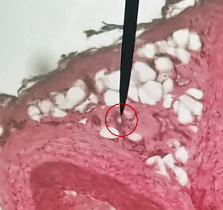 <p>What is the pointer on?</p>