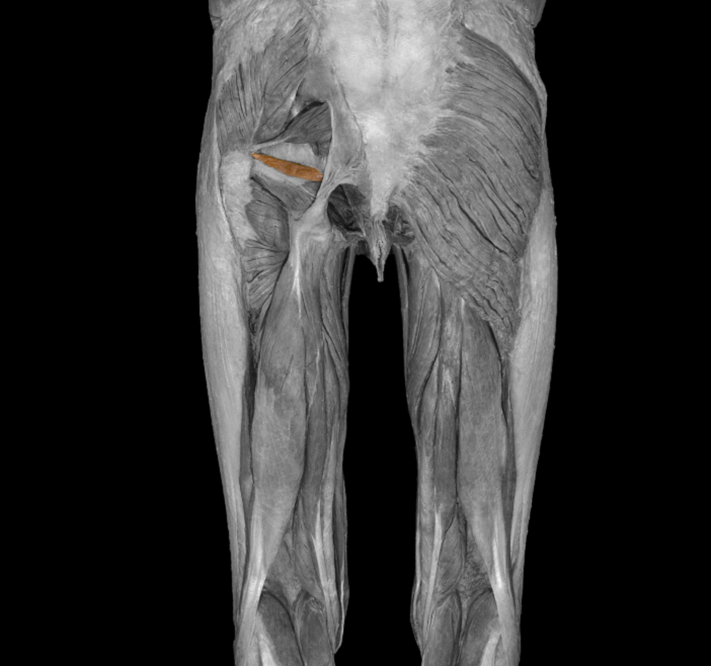 <p>beginning of GOGO complex</p><p></p><p>origin: ischial spine</p><p></p><p>insertion: medial surface of greater trochanter of femur</p><p></p><p>action: laterally rotate + abduct thigh at hip</p><p></p><p>innervation: nerve to obturator internees</p>