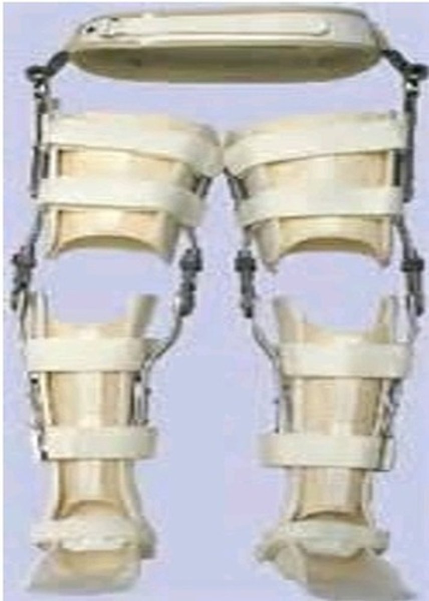 <p>post-polio with residual paralysis</p>