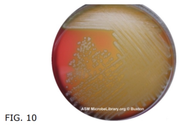 <p>hemolysis type?</p>