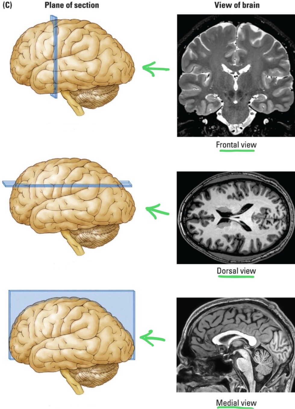 <p>The anatomical locations with respect to a viewer’s perspective:</p>