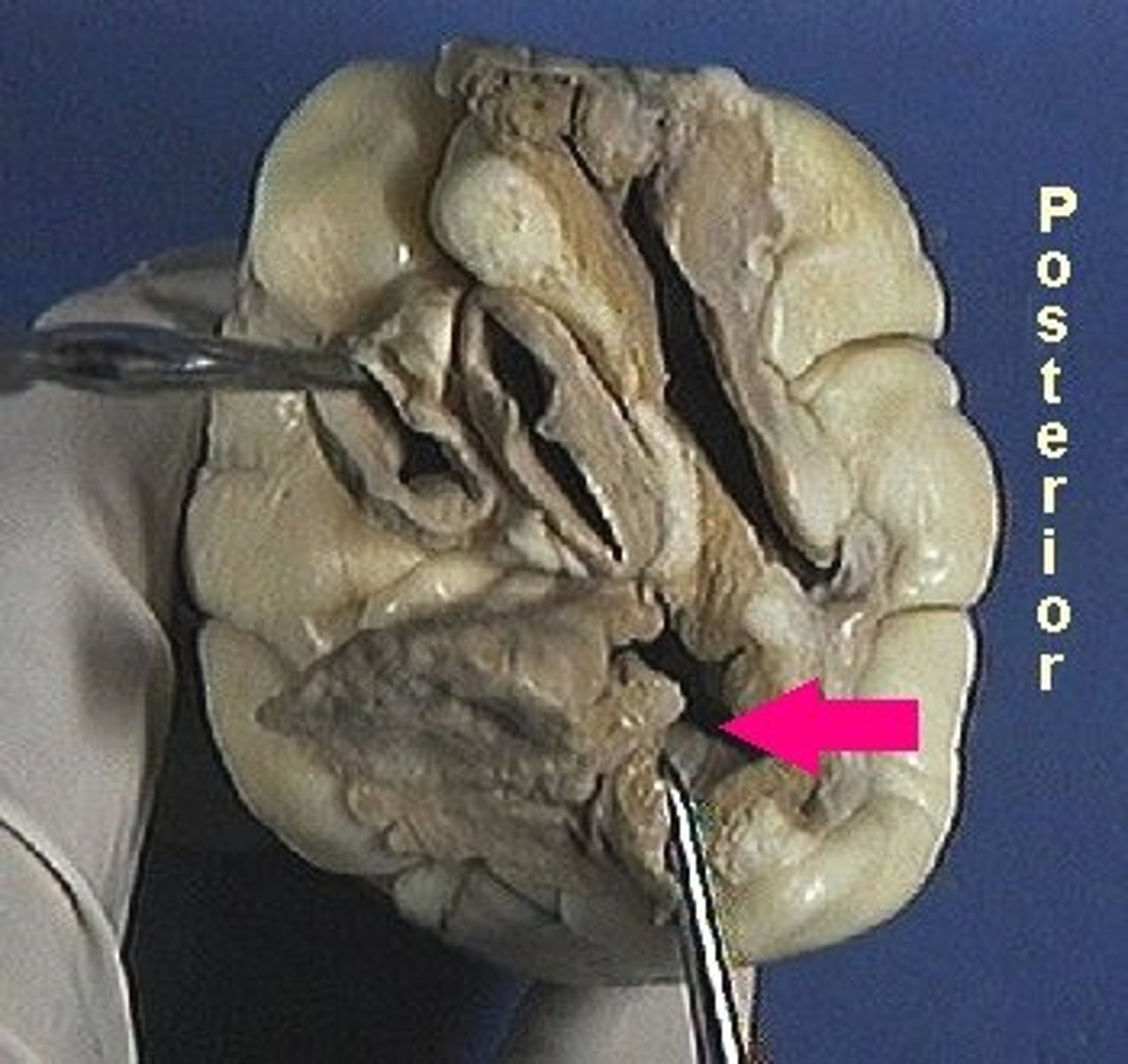 <p>Identify the chamber.</p>