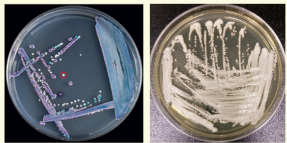 <p><span style="color: #f9f9f9">There have been reports of C. auris being misidentified as Candida</span><span style="color: #f9f9f9"><br></span><span style="color: #f9f9f9">lusitaniae and Candida famata on VITEK 2. A confirmatory test such</span><span style="color: #f9f9f9"><br></span><span style="color: #f9f9f9">as cornmeal agar may be warranted for these species.</span><span style="color: #f9f9f9"><br></span><span style="color: #f9f9f9">4 C. guilliermondii, C. lusitaniae, and C. parapsilosis generally make</span><span style="color: #f9f9f9"><br></span><span style="color: #f9f9f9">pseudohyphae on cornmeal agar.</span><span style="color: #f9f9f9"><br></span><span style="color: #f9f9f9">4 If hyphae or pseudohyphae are not present on cornmeal agar, this</span><span style="color: #f9f9f9"><br></span><span style="color: #f9f9f9">should raise suspicion for C. auris as C. auris typically does not make</span><span style="color: #f9f9f9"><br></span><span style="color: #f9f9f9">hyphae or pseudohyphae.</span><span style="color: #f9f9f9"><br></span><span style="color: #f9f9f9">4 An increase in infections due to unidentified Candida species in a</span><span style="color: #f9f9f9"><br></span><span style="color: #f9f9f9">patient care unit, including increases in isolation of Candida from urine</span><span style="color: #f9f9f9"><br></span><span style="color: #f9f9f9">specimens, should also prompt suspicion for C. auris, since C.</span><span style="color: #f9f9f9"><br></span><span style="color: #f9f9f9">auris can be transmitted in healthcare settings.</span></p>