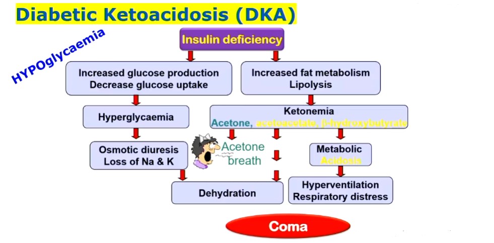 <ul><li><p>insulin deficiency → increased glucose production (gluconeogenesis) BUT decreased glucose uptake = <u>hyperglycaemia</u> → increased excretion of glucose (and water) via kidneys = <u>dehydration</u></p></li><li><p>insulin deficiency → increased fat metabolism (lipolysis) → ketonemia (high amount of formation of ketone bodies) = acetone breath, <u>metabolic acidiosis</u> → hyperventilation respiratory distress</p></li></ul>