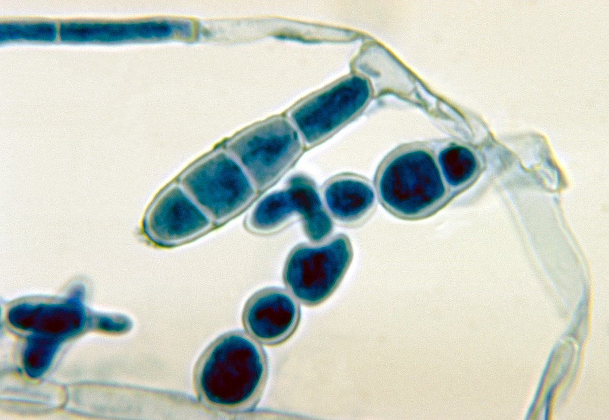 <p>What dermatophyte is this?</p>