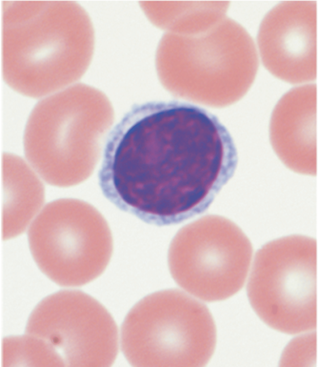 <p><span>ONLY ACQUIRED IMMUNITY </span></p><p><span>T cells, B cells, Natural killer cells</span><span><br></span><span>Have a halo effect/ring around the nucleus</span></p>
