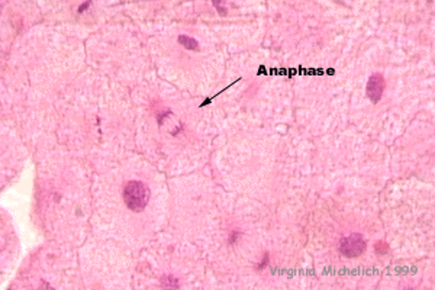<p>chromatin starts to move to opposite poles of the cell</p>