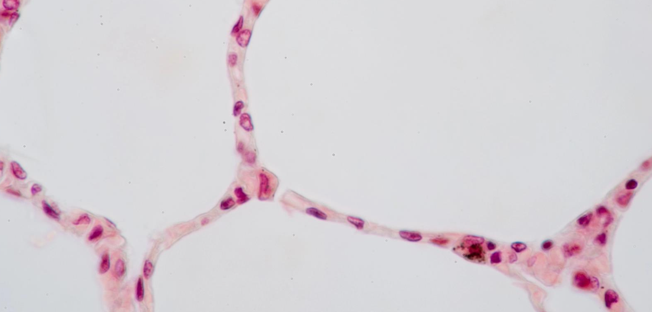 <p><strong>Name this tissue type?</strong></p>