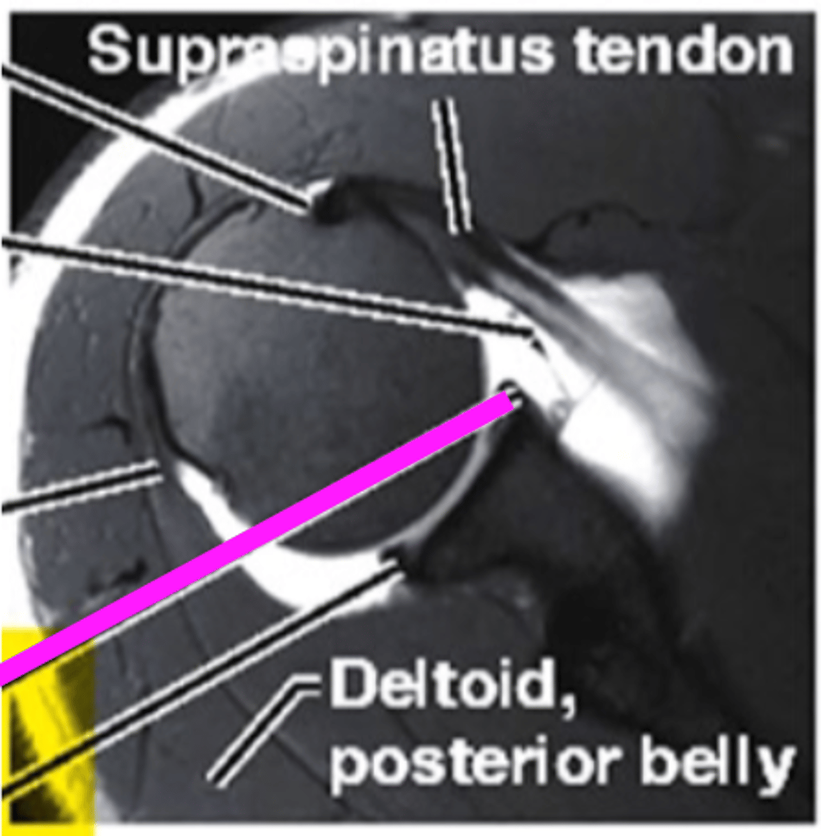 <p>what does the pink line point to?</p>