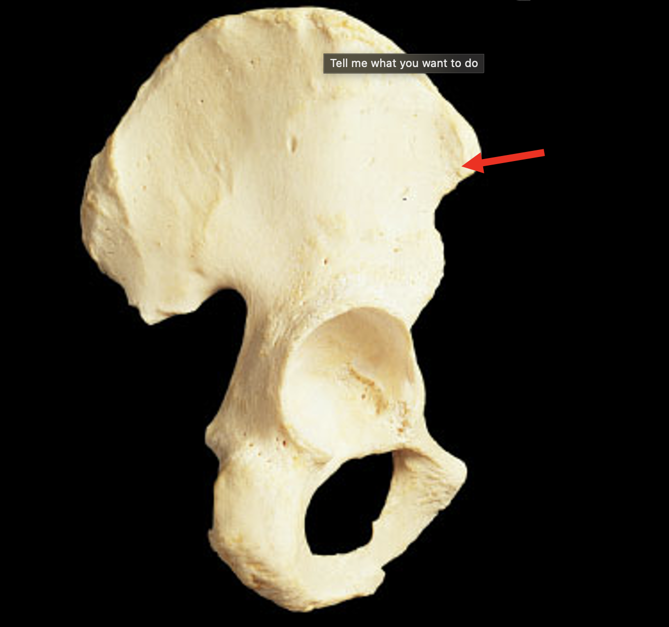Name this region of the pelvis