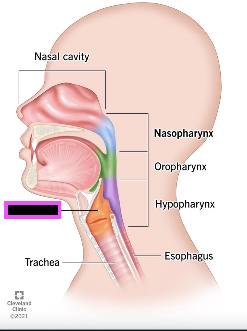term image