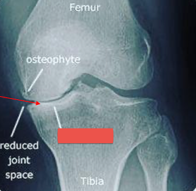 <p>What is the arrow pointing to? </p>