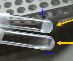 <p>coagulase test</p>